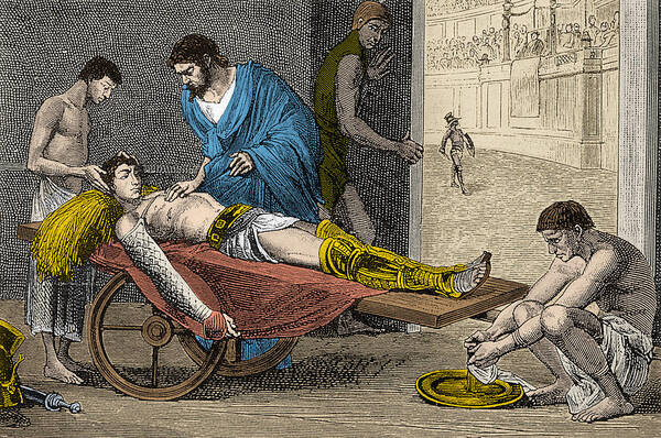 Science Poster featuring the photograph Galen Treating Gladiator by Science Source