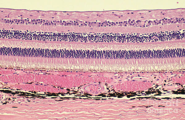 Retina Poster featuring the photograph Retina, Lm by Ralph C. Eagle, Jr.