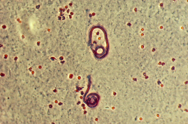 Wuchereria Bancrofti Poster featuring the photograph Wucheria Bancrofti, Parasite by Robert Knauft / Biology Pics