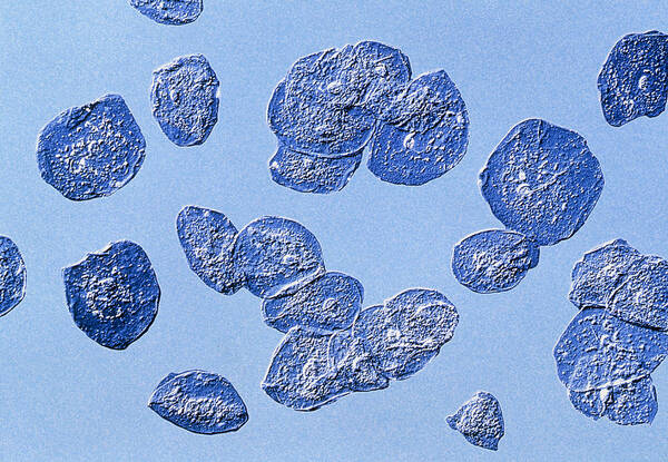 Epithelium Poster featuring the photograph Computer-enhanced Lm Of Human Epithelial Cells by Pasieka