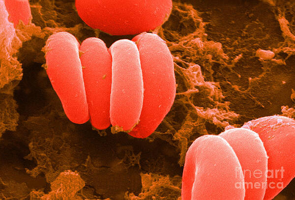 Biology Poster featuring the photograph Red Blood Cells, Rouleaux Formation, Sem by Science Source