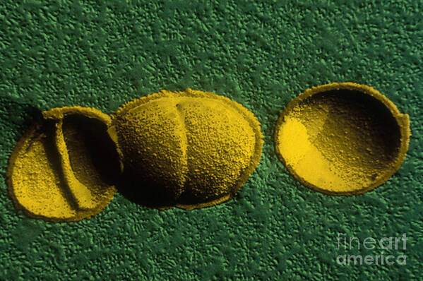 Streptococcus Thermophilus Poster featuring the photograph Streptococcus Thermophilus, Tem #2 by Scimat