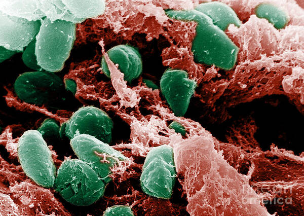 Microbiology Poster featuring the photograph Yersinia Pestis Bacteria, Sem #8 by Science Source