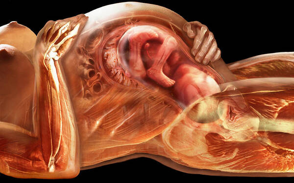 Anatomical Illustration Poster featuring the photograph Pregnant Woman #1 by Anatomical Travelogue