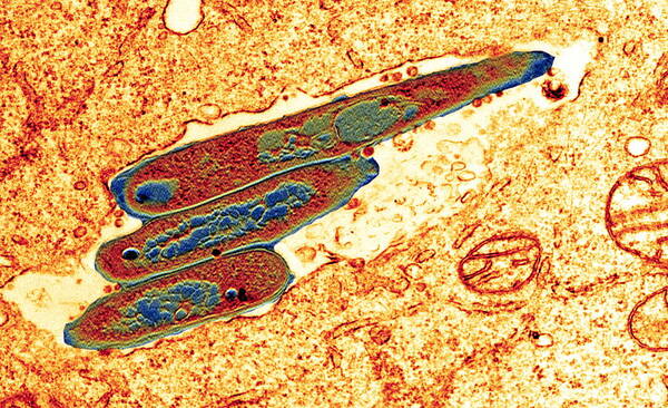 Mycobacterium Tuberculosis Poster featuring the photograph Macrophage Cell Engulfing Bacteria, Tem by 