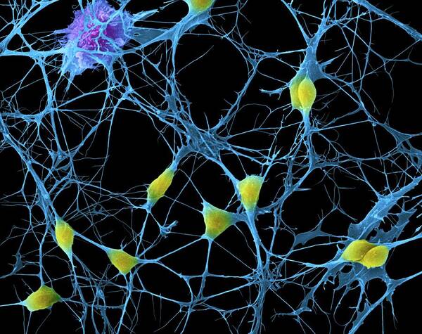 8705g Poster featuring the photograph Cortical Neurons #1 by Dennis Kunkel Microscopy/science Photo Library