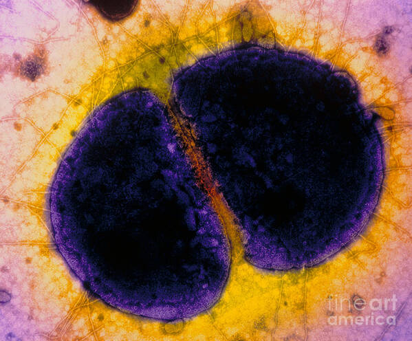 Color Enhanced Tem Poster featuring the photograph Neisseria Gonorrhoeae #1 by Kwangshin Kim