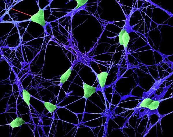 Central Nervous System Poster featuring the photograph Cortical Neurons #10 by Dennis Kunkel Microscopy/science Photo Library