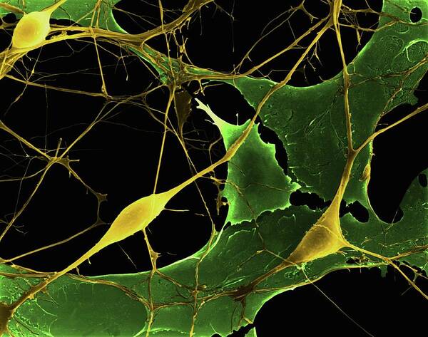 92752a Poster featuring the photograph Pyramidal Neurons From Cns #10 by Dennis Kunkel Microscopy/science Photo Library