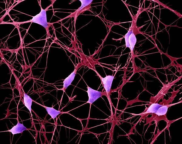 8799h Poster featuring the photograph Cortical Neurons #8 by Dennis Kunkel Microscopy/science Photo Library