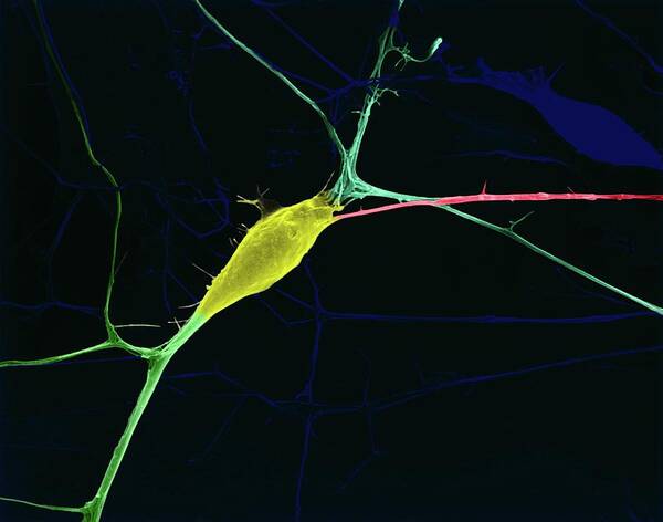 92753a Poster featuring the photograph Neuron Growing In Culture by Dennis Kunkel Microscopy/science Photo Library