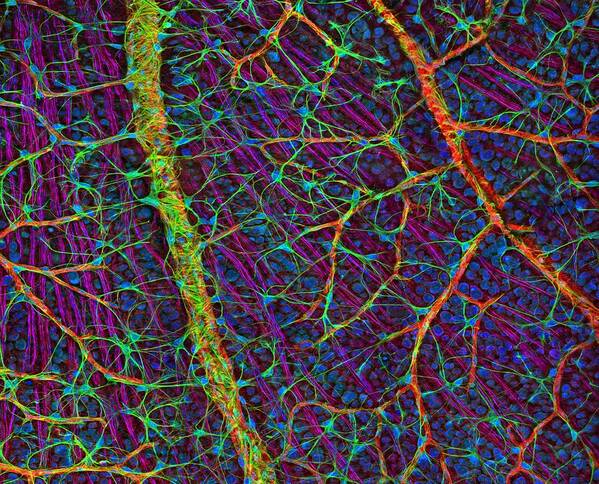 Eye Poster featuring the photograph Retina Blood Vessels And Nerve Cells by Thomas Deerinck, Ncmir