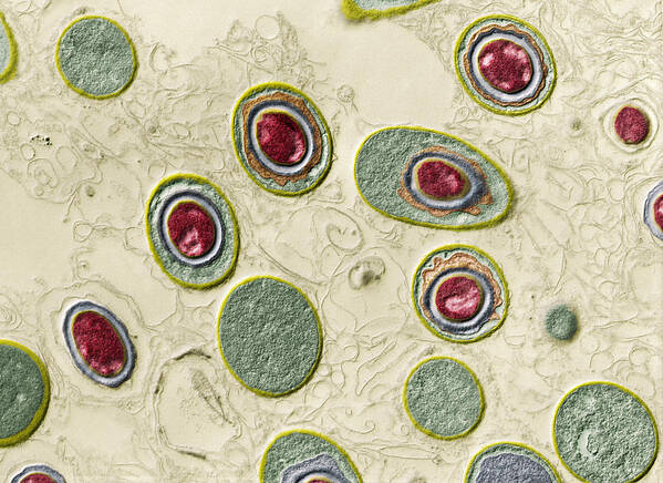 Bacteria Poster featuring the photograph Anthrax Bacteria, Bacillus Anthracis #1 by Eye of Science