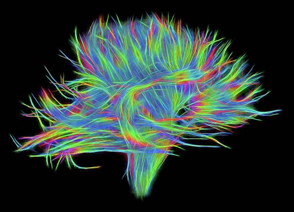 Black Background Poster featuring the photograph White Matter Fibres Of The Human Brain #12 by Alfred Pasieka/science Photo Library
