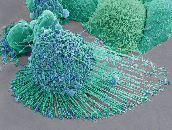 Science Poster featuring the photograph Apoptotic Hela Cell, Sem #4 by Science Source