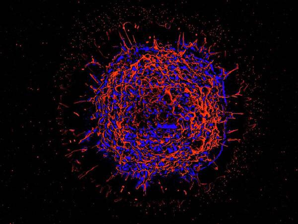 Alveolar Macrophage Poster featuring the photograph Alveolar Macrophage #5 by Microscopy Core Facility, Vib Gent