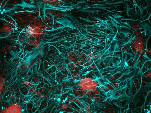 Biological Poster featuring the photograph Stem cell-derived nerve cells #9 by Science Photo Library