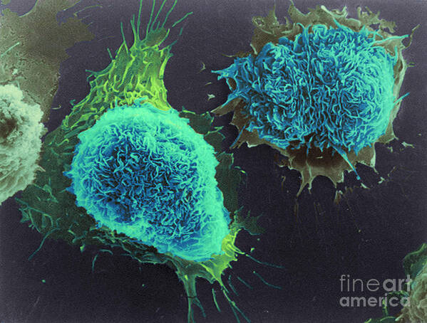 Science Poster featuring the photograph Cultured Cells, Sem by Science Source