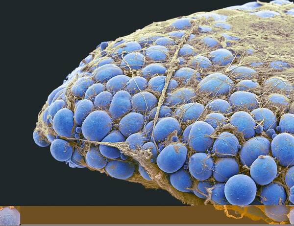 Adipocyte Poster featuring the photograph Fat tissue, SEM by Science Photo Library