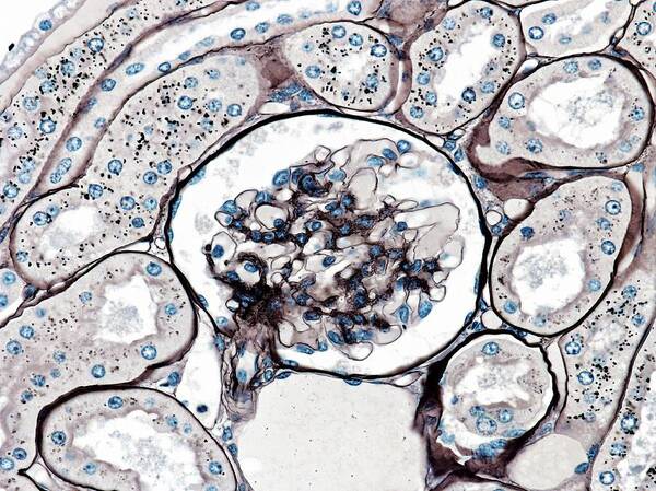 Glomerulus Poster featuring the photograph Glomerulus by Microscape