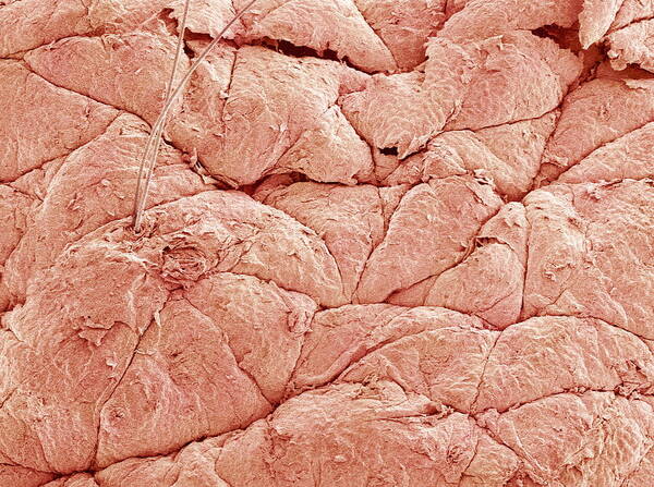 Stratum Corneum Poster featuring the photograph Human Skin, Sem #1 by Susumu Nishinaga