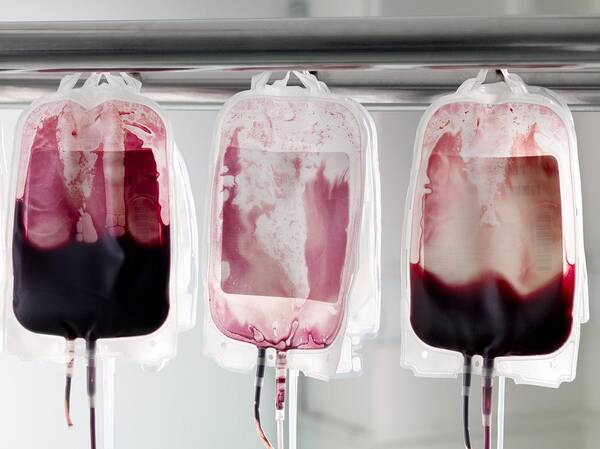 Blood Poster featuring the photograph Donor Blood Processing by Tek Image