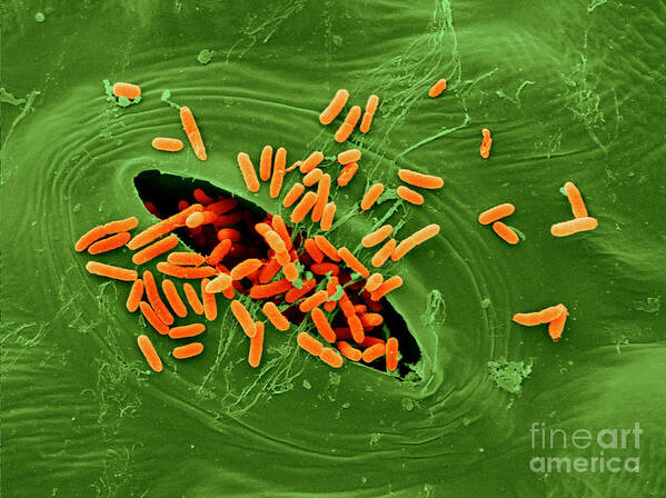 Escherichia Coli Poster featuring the photograph Sem Of E. Coli Bacteria On Lettuce #11 by Scimat