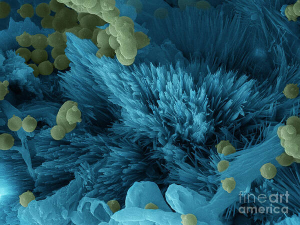 Blue Poster featuring the photograph Blue Cheese, Sem #3 by Ted Kinsman