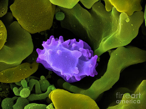 Lymphocyte Poster featuring the photograph Human Lymphocyte Cell, Sem #2 by Ted Kinsman