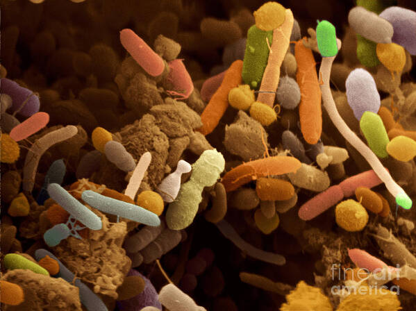 Human Poster featuring the photograph Bacteria In Human Feces, Sem by Scimat