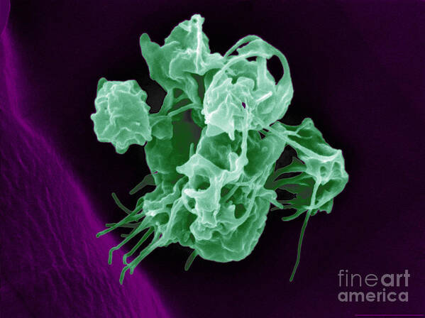 Thrombocyte Poster featuring the photograph Human Thrombocytes Platelets, Sem by Scimat