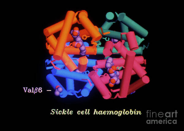 Computer Graphic Poster featuring the photograph Computer Graphics Of Sickle Cell Haemoglobin by Professor Arthur Lesk/science Photo Library