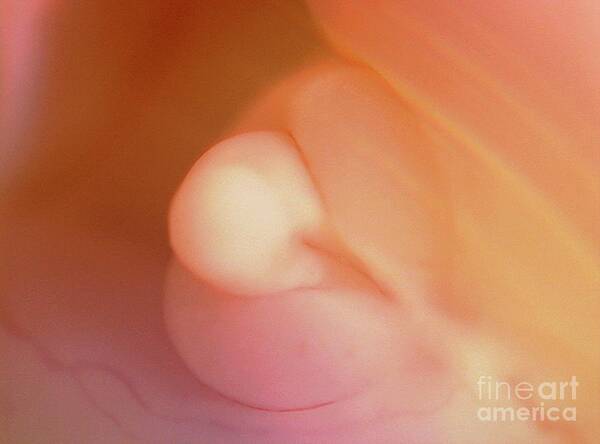 Anatomical Poster featuring the photograph Foetal Development by Thierry Berrod, Mona Lisa Production/science Photo Library