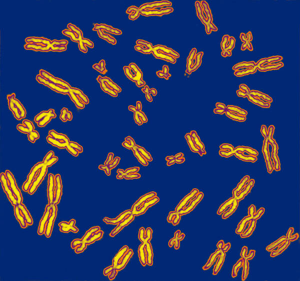 Chromosome Poster featuring the photograph Human Chromosomes #5 by Biophoto Associates