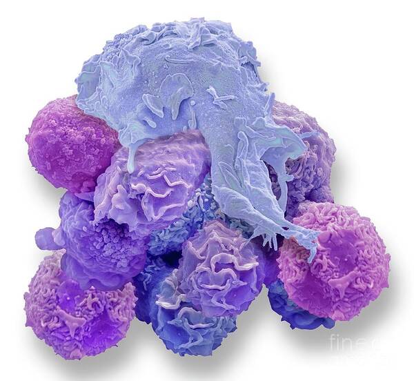 Abnormal Poster featuring the photograph Macrophage And Cancer Cell by Steve Gschmeissner/science Photo Library
