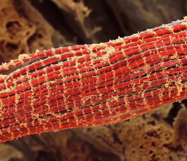 Muscle Poster featuring the photograph Skeletal Muscle Fibres #1 by Steve Gschmeissner