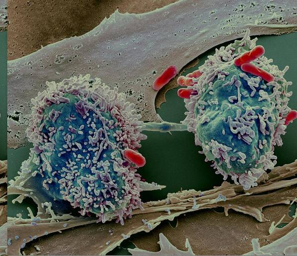 Abnormal Poster featuring the photograph Dividing cancer cell, SEM #2 by Science Photo Library