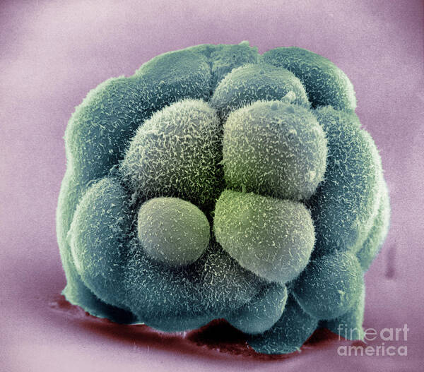 Scanning Electron Micrograph Poster featuring the photograph Mouse Embryo #5 by David M. Phillips