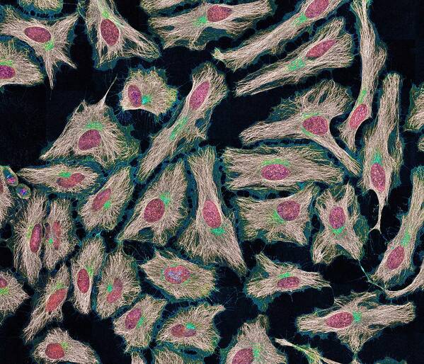 Abnormal Poster featuring the photograph HeLa cells, light micrograph by Science Photo Library