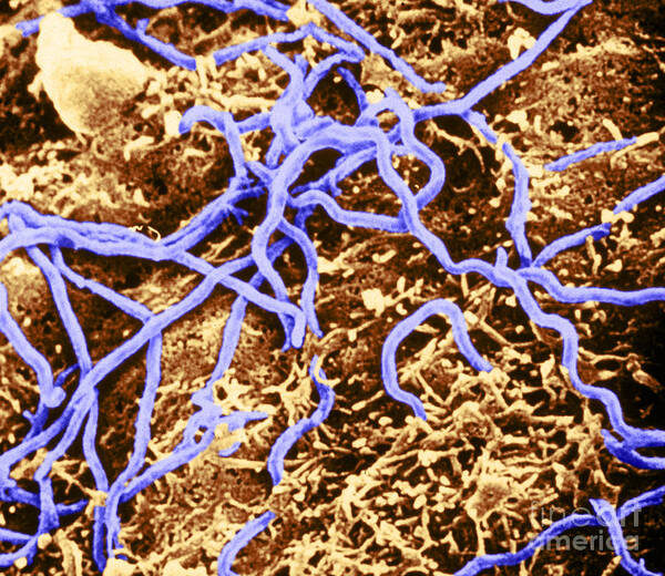 Micrograph Poster featuring the photograph Borrelia Burgdorferi #3 by Science Source