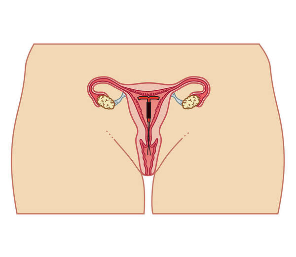 Cervix Poster featuring the digital art Cross Section Biomedical Illustration #9 by Dorling Kindersley