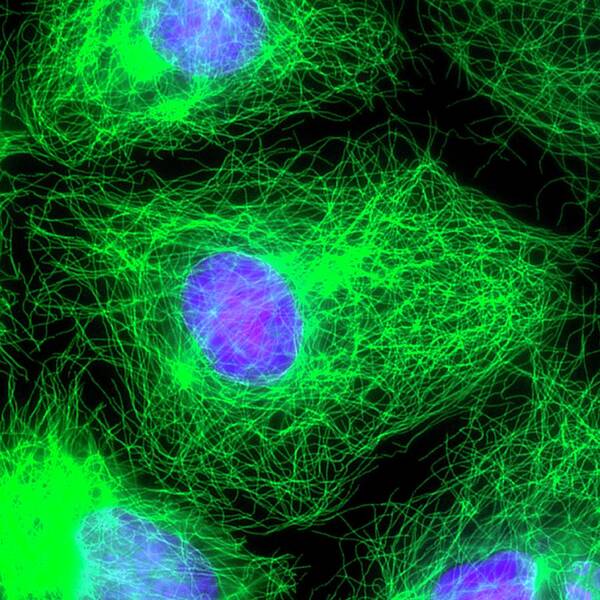 Interphase Poster featuring the photograph Cell Division #1 by Dr Torsten Wittmann