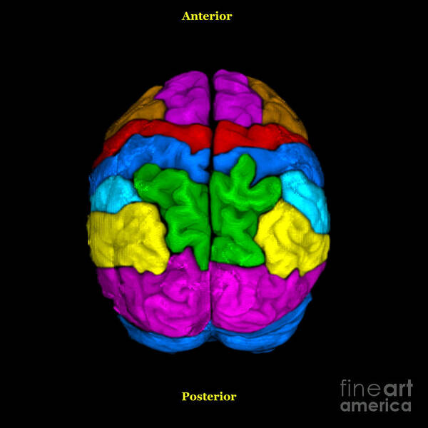 Science Poster featuring the photograph Mri Of Normal Brain #2 by Living Art Enterprises