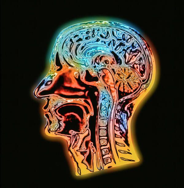 Brain Poster featuring the photograph Coloured Mri Scan Of The Human Head (side View) by Alfred Pasieka/science Photo Library
