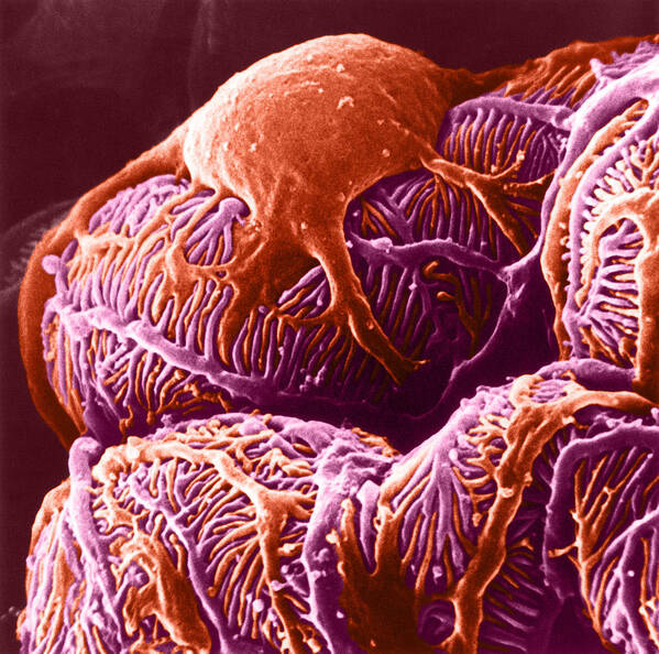 System Poster featuring the photograph Kidney Glomerulus, Sem by Don W. Fawcett