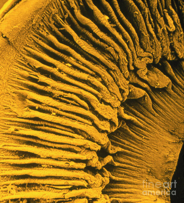 Iris Poster featuring the photograph Ciliary Body And Iris Of The Eye by Cnri/science Photo Library