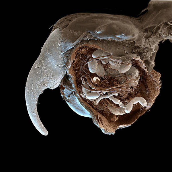 Sand Flea Eggs Embedded In Rat Claw, SEM Poster by Eye Of Science - Fine Art  America