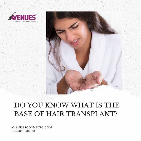 Do You Know What Is The Base Of Hair Transplant? Poster by Aneues hairs -  Fine Art America