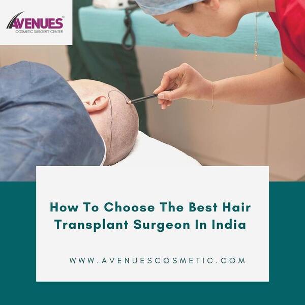 How To Choose The Best Hair Transplant Surgeon In India Poster by Aneues  hairs - Fine Art America
