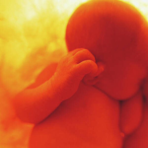 Color Poster featuring the photograph Womb Series #10 by Anne Geddes